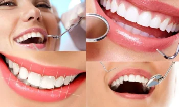 İstanbul’da Estetik Diş Hekimliği - Cosmetic Dentistry in İstanbul Fiyatları